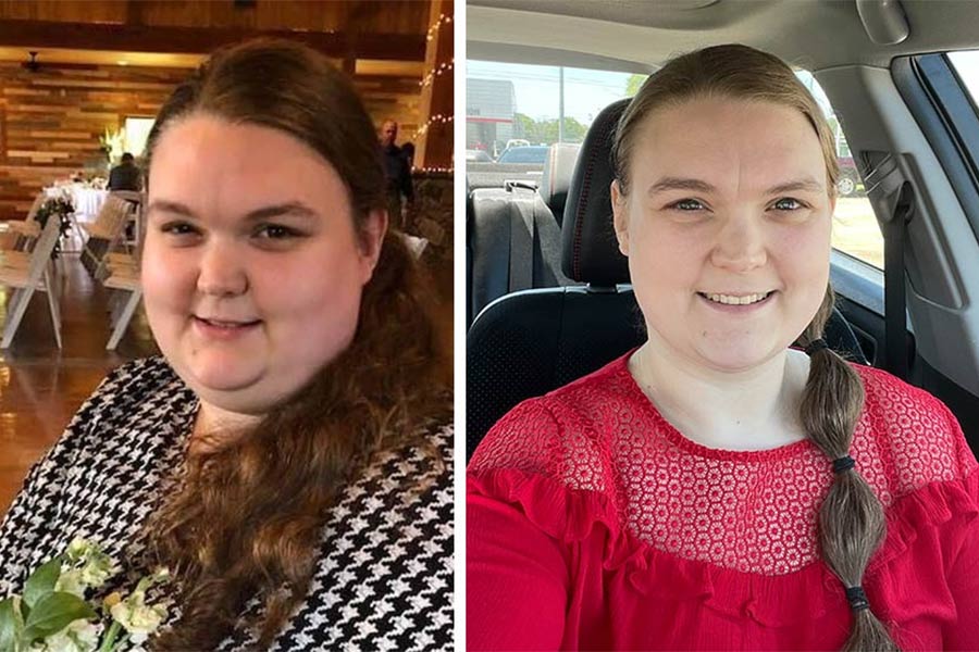 woman before and after 100lb weight loss